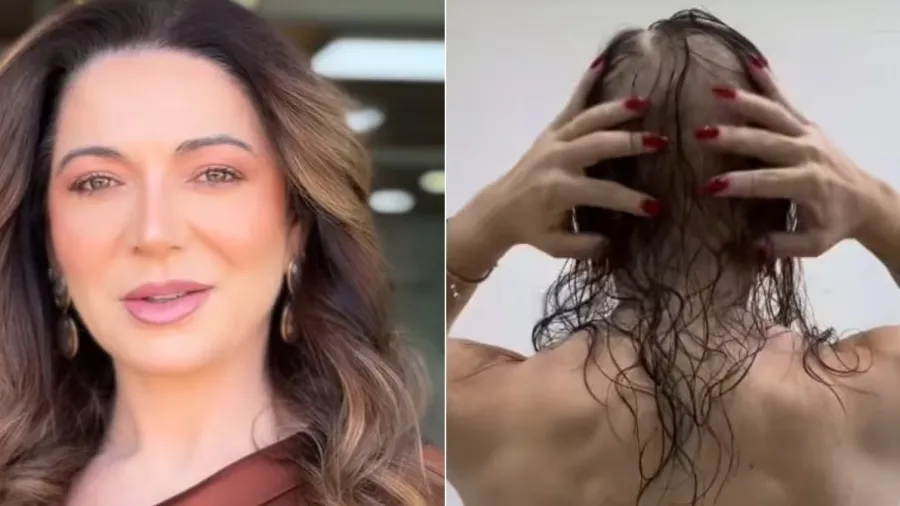 Superação: Karina Lucco compartilha jornada real após diagnóstico de alopecia areata
