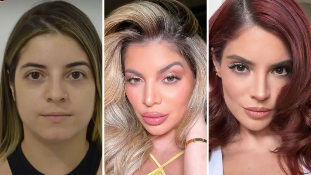 Gkay admite exageros em procedimentos: “Tive distorção de imagem”